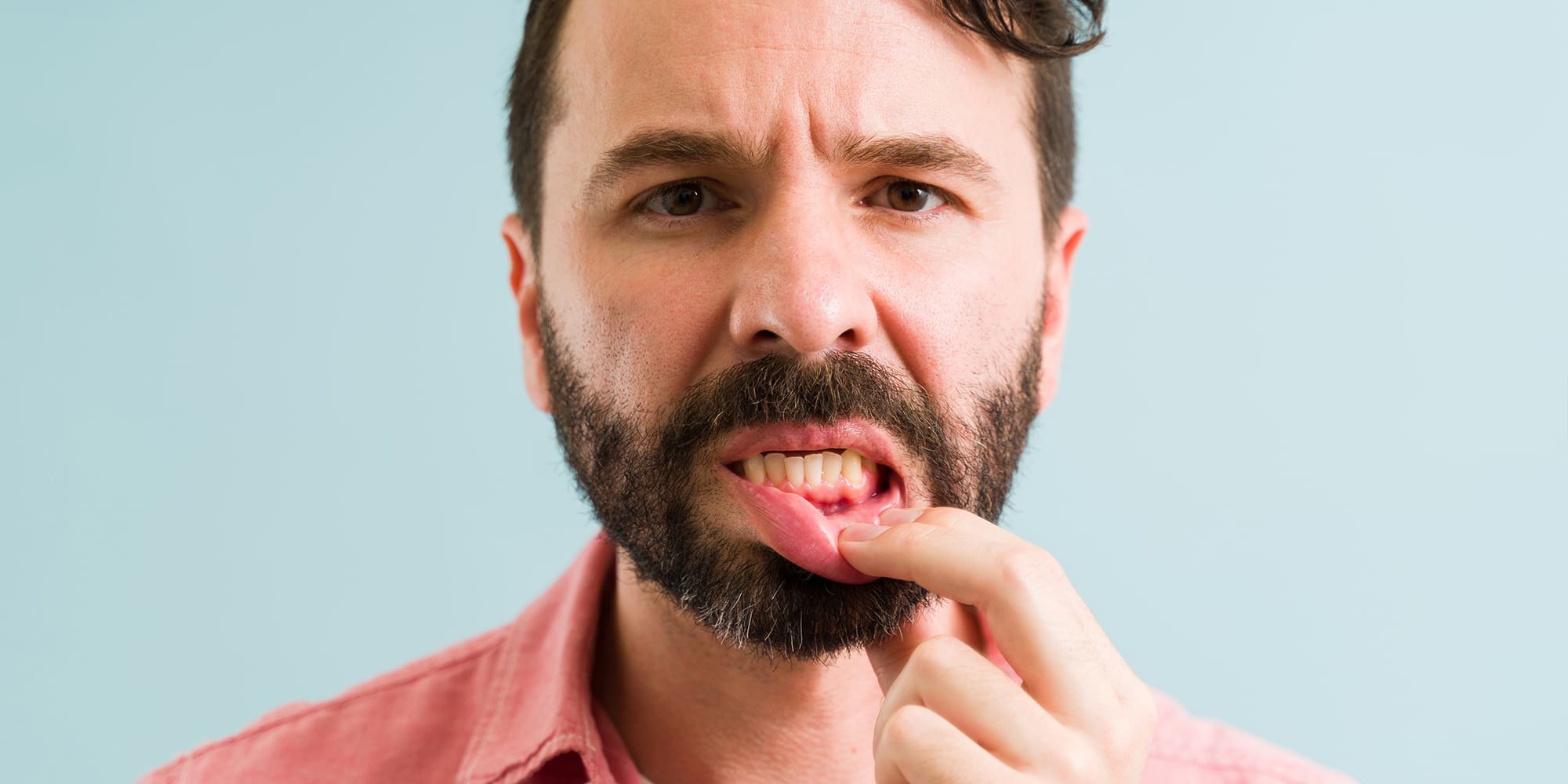 Why You Have Bleeding Gums Even With Good Oral Hygiene